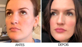 Creme Retinol Anti Rugas Para os Olhos