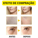 Sérum Anti-Rugas com Retinol [COMPRE 1 E LEVE 2]