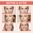 Tônico Facial Hidratante de Rosa e Ácido Hialurônico